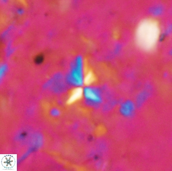 Sphenolithus abies 19776