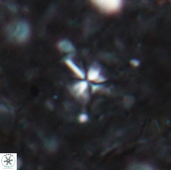 Sphenolithus abies 19778