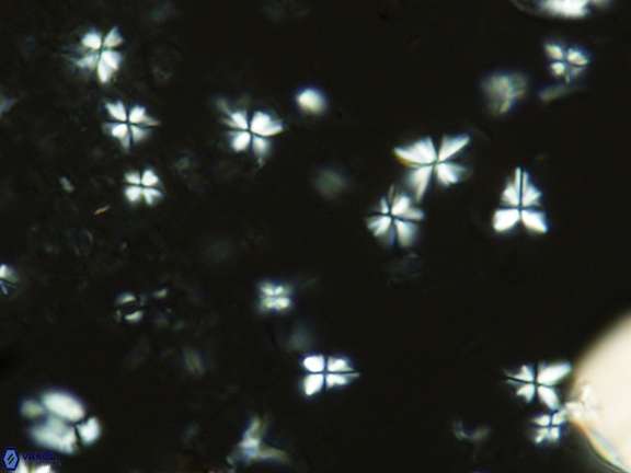 Sphenolithus abies VR 07184 1