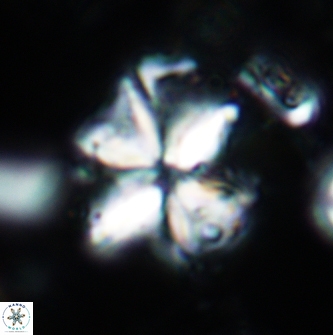Sphenolithus acervus 1981