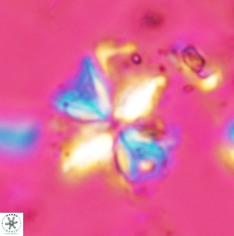 Sphenolithus acervus 1982