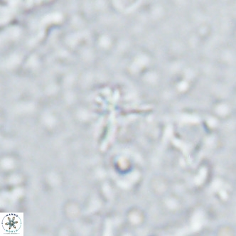 Sphenolithus alatus VR 16399