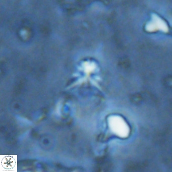 Sphenolithus alatus VR 16404