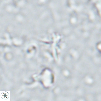 Sphenolithus alatus VR 16402