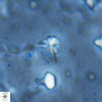Sphenolithus alatus VR 16403