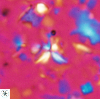Sphenolithus alatus 27135