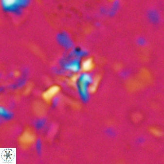Sphenolithus alatus 27144