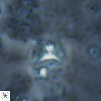 Sphenolithus alatus 27148