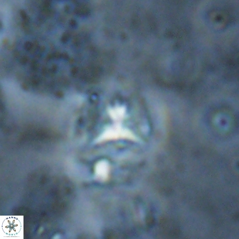 Sphenolithus alatus 27149