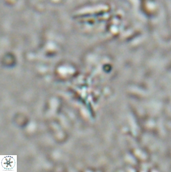 Sphenolithus alatus 27140