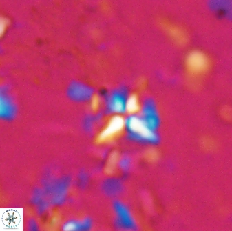 Sphenolithus alatus 27143