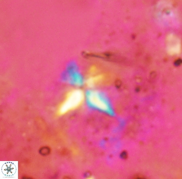Sphenolithus alatus 2359
