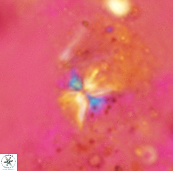 Sphenolithus alatus 2361