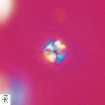 Sphenolithus apoxis VR 31151