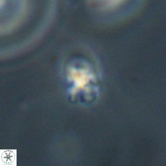 Sphenolithus apoxis VR 31170