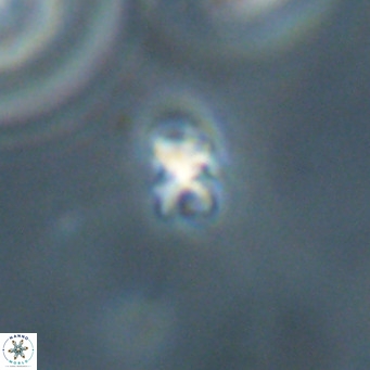 Sphenolithus apoxis VR 31171