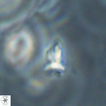 Sphenolithus apoxis VR 31172