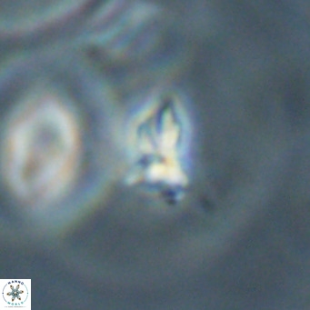 Sphenolithus apoxis VR 31173