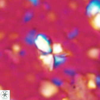 Sphenolithus apoxis 28027