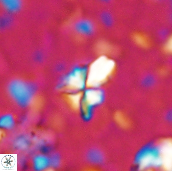 Sphenolithus apoxis 28029