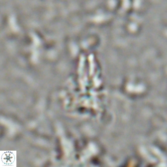 Sphenolithus apoxis 28030