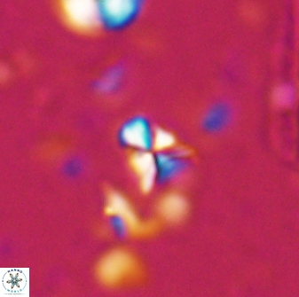 Sphenolithus apoxis 28104