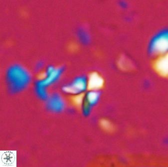 Sphenolithus apoxis 28107
