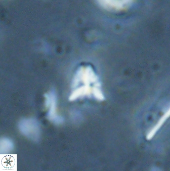 Sphenolithus apoxis 28110