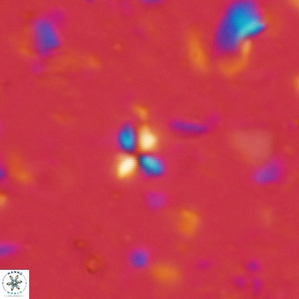 Sphenolithus apoxis 75