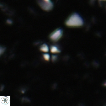 Sphenolithus apoxis 76
