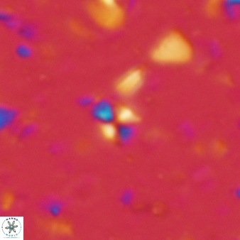 Sphenolithus apoxis 77