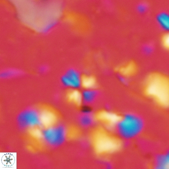 Sphenolithus apoxis 98