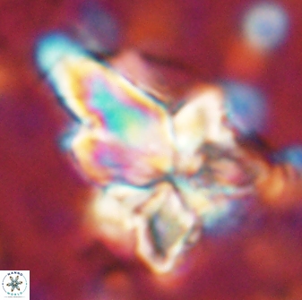 Sphenolithus asper 58627