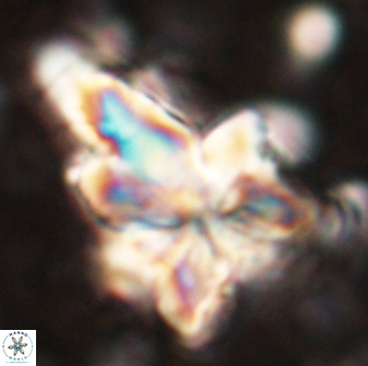 Sphenolithus asper 58628