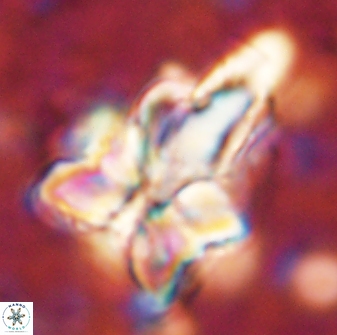 Sphenolithus asper 58630