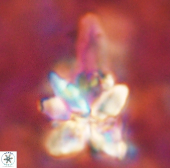 Sphenolithus asper 58634