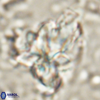 Sphenolithus asper 58635