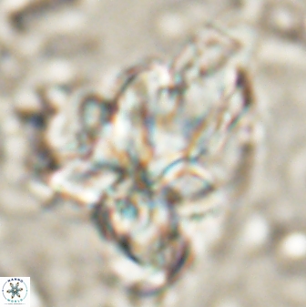 Sphenolithus asper 58635