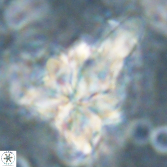 Sphenolithus asper 58636