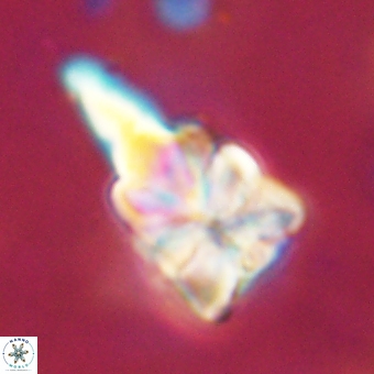 Sphenolithus asper 69101