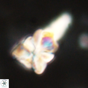 Sphenolithus asper 69103