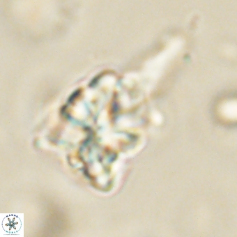 Sphenolithus asper 69105