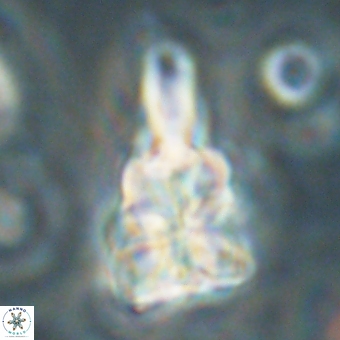 Sphenolithus asper 69109