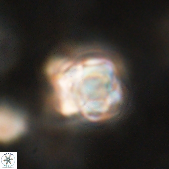 Sphenolithus asper 69112
