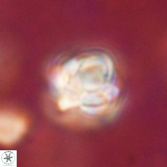 Sphenolithus asper 69113