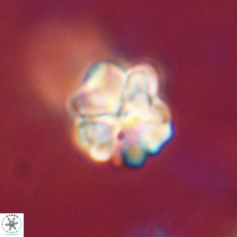 Sphenolithus asper 69116