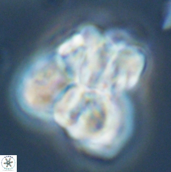 Sphenolithus atlandicus 25899