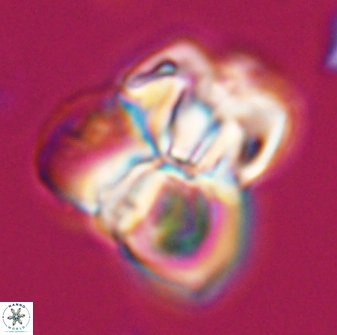 Sphenolithus atlandicus 25901