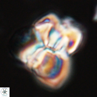 Sphenolithus atlandicus 25902