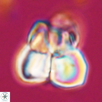 Sphenolithus atlandicus 25903